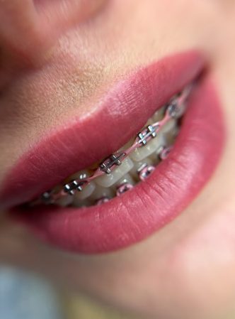 IMG_0850 IMG_0850